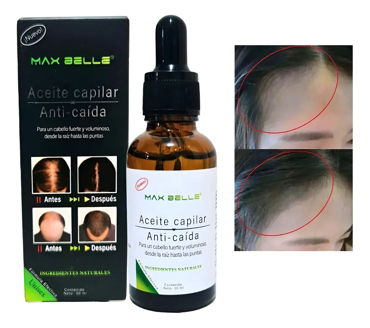Beneficios Serum Capilar Anticaída